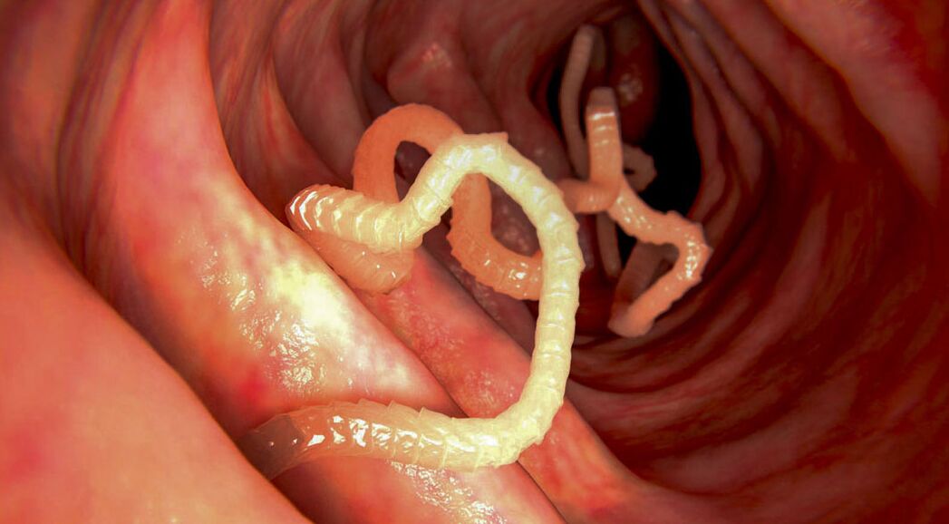 diagnosticul paraziților în intestine