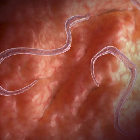 Paraziți în intestine