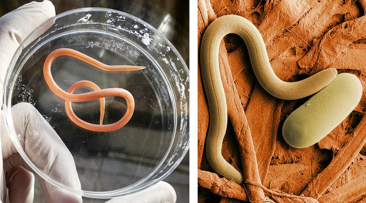 paraziți în corpul uman